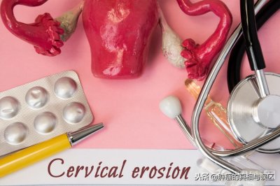 ​宫颈癌的原因 诱因有哪些？没其他，就这三个